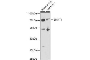 Western blot analysis of extracts of various cell lines, using SPINT1 antibody (ABIN6131743, ABIN6148359, ABIN6148360 and ABIN6222046) at 1:1000 dilution. (SPINT1 anticorps  (AA 234-513))