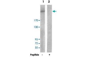 Western blot analysis of extracts from HepG2 cells, using PIKFYVE polyclonal antibody . (PIKFYVE anticorps)