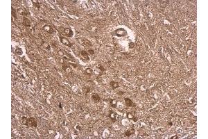 IHC-P Image UBE3A antibody detects UBE3A protein at cytosol on mouse middle brain by immunohistochemical analysis. (ube3a anticorps)