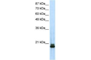 WB Suggested Anti-SAAntibody Titration:  0. (SAP18 anticorps  (N-Term))