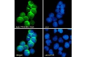 (ABIN7505819) Immunofluorescence analysis of paraformaldehyde fixed Jurkat cells, permeabilized with 0.