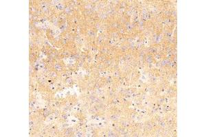 Immunohistochemistry analysis of paraffin embedded mouse Hippocampus using Nrg4 (ABIN7074805) at dilution of 1: 300 (Neuregulin 4 anticorps)