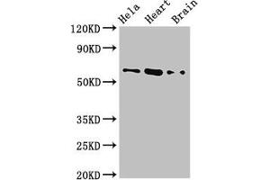 Western Blot Positive WB detected in: Hela whole cell lysate, Mouse heart tissue, Mouse brain tissue All lanes: BAIAP2 antibody at 3. (BAIAP2 anticorps  (AA 123-368))
