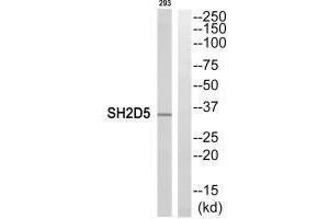 Western blot analysis of extracts from 293 cells, using SH2D5 antibody. (SH2D5 anticorps  (C-Term))