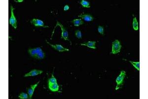 Immunofluorescent analysis of U251 cells using ABIN7173610 at dilution of 1:100 and Alexa Fluor 488-congugated AffiniPure Goat Anti-Rabbit IgG(H+L)