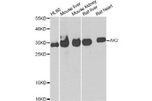 Western blot analysis of extracts of various cell lines, using AK2 antibody. (Adenylate Kinase 2 anticorps  (AA 1-232))
