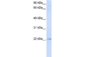 WB Suggested Anti-TMEM9 Antibody Titration:  0. (TMEM9 anticorps  (C-Term))
