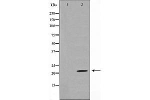 Western blot analysis on rat liver cell lysate using Claudin 7 Antibody,The lane on the left is treated with the antigen-specific peptide. (Claudin 7 anticorps  (C-Term))