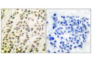 Immunohistochemistry (IHC) image for anti-Transglutaminase 4 (Prostate) (TGM4) (C-Term) antibody (ABIN6299265) (TGM4 anticorps  (C-Term))
