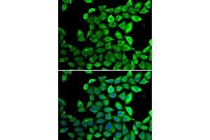 Immunofluorescence analysis of U20S cell using PPID antibody. (PPID anticorps)
