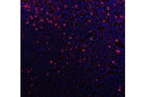 IF analysis of CD79b using anti-CD79b antibody (ABIN3043398). (CD79b anticorps  (AA 29-229))