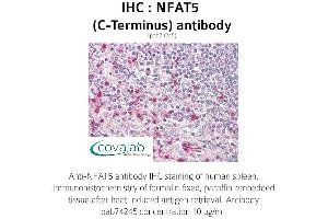 Image no. 1 for anti-Nuclear Factor of Activated T-Cells 5, Tonicity-Responsive (NFAT5) antibody (ABIN1737328) (NFAT5 anticorps)