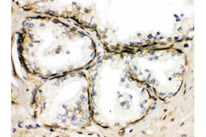 IHC analysis of TRPM5 using anti-TRPM5 antibody (ABIN3044566).
