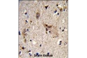 Formalin-fixed and paraffin-embedded human brain tissue reacted with ALDH18A1 Antibody (Center), which was peroxidase-conjugated to the secondary antibody, followed by DAB staining. (P5CS anticorps  (AA 176-205))