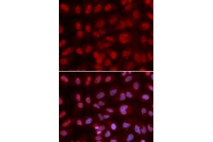 Immunofluorescence analysis of U2OS cell using SIN3A antibody. (SIN3A anticorps  (AA 1-120))