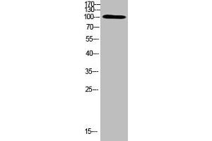 Western Blot analysis of HEPG2 cells using Antibody diluted at 500 (TRPV4 anticorps  (AA 461-510))
