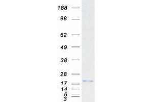 Validation with Western Blot