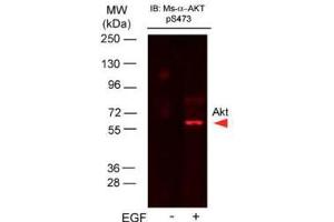 Western Blot of Mouse Anti-AKTpS473 antibody.