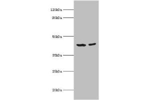 Western blot All lanes: Short-chain specific acyl-CoA dehydrogenase, mitochondrial antibody at 7 μg/mL Lane 1: 293T whole cell lysate Lane 2: HepG2 whole cell lysate Secondary Goat polyclonal to rabbit IgG at 1/10000 dilution Predicted band size: 44 kDa Observed band size: 44 kDa