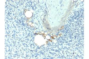 Formalin-fixed, paraffin-embedded human Spleen stained with TRAcP Mouse Monoclonal Antibody (ACP5/1070). (ACP5 anticorps)