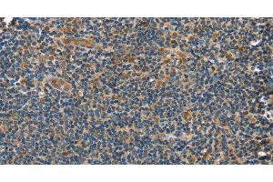 Immunohistochemistry of paraffin-embedded Human tonsil tissue using GRB7 Polyclonal Antibody at dilution 1:40 (GRB7 anticorps)