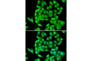 Immunofluorescence analysis of HeLa cells using NEK3 antibody. (NEK3 anticorps  (AA 267-506))