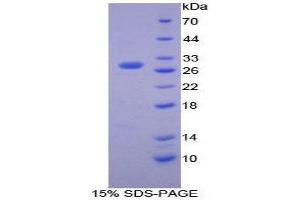 SDS-PAGE (SDS) image for Matrix Metallopeptidase 15 (Membrane-inserted) (MMP15) (AA 336-539) protein (His tag) (ABIN2125806)