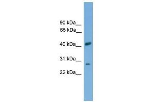 Western Blot showing SLC25A37 antibody used at a concentration of 1-2 ug/ml to detect its target protein. (SLC25A37 anticorps  (Middle Region))