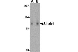 Western Blotting (WB) image for anti-SLIT and NTRK-Like Family, Member 1 (SLITRK1) (Middle Region) antibody (ABIN1031098) (SLITRK1 anticorps  (Middle Region))