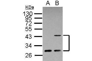 WB Image Sample (30 ug of whole cell lysate) A: A431 B: HeLa 12% SDS PAGE antibody diluted at 1:500 (ING1 anticorps  (C-Term))