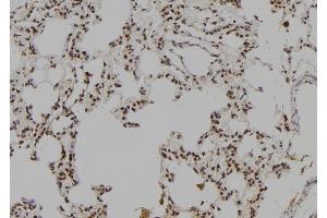 ABIN6277041 at 1/100 staining Rat lung tissue by IHC-P.