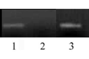 Histone H3 monomethyl Lys4 antibody (mAb) tested by ChIP. (Histone 3 anticorps  (H3K4me))