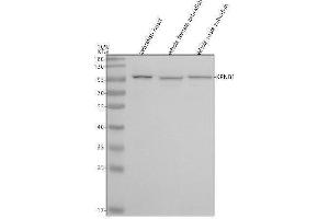 Western blot analysis of Importin Beta/KPNB1 using anti-Importin Beta/KPNB1 antibody (AZA0A0R4IMZ8).