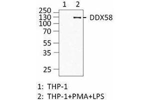 Western Blotting (WB) image for anti-DEAD (Asp-Glu-Ala-Asp) Box Polypeptide 58 (DDX58) antibody (ABIN2664928) (DDX58 anticorps)
