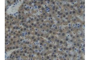 Detection of AST in Rat Liver Tissue using Polyclonal Antibody to Aspartate Aminotransferase (AST)