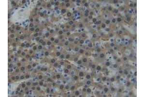 Detection of AST in Rat Liver Tissue using Polyclonal Antibody to Aspartate Aminotransferase (AST) (GOT1 anticorps  (AA 1-413))