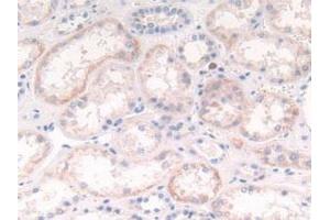 Detection of CTSG in Human Kidney Tissue using Polyclonal Antibody to Cathepsin G (CTSG)