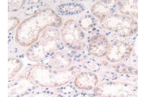Detection of CTSG in Human Kidney Tissue using Polyclonal Antibody to Cathepsin G (CTSG) (Cathepsin G anticorps  (AA 21-255))