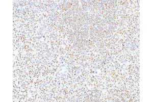 Immunohistochemistry (IHC) image for anti-CCCTC-Binding Factor (Zinc Finger Protein) (CTCF) (AA 650-700) antibody (ABIN7453967) (Recombinant CTCF anticorps  (AA 650-700))