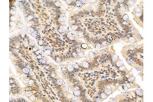 ABIN6263157 and ABIN6273006 at 1/100 staining Rat colon tissue by IHC-P.