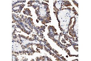 IHC analysis of VAPB using anti-VAPB antibody (ABIN5693292). (VAPB anticorps  (AA 2-55))
