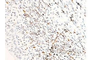 ABIN6267285 at 1/100 staining human TB tissue sections by IHC-P.