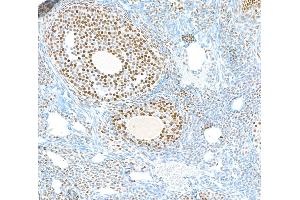 Immunohistochemistry (IHC) image for anti-Poly (ADP-Ribose) Polymerase 1 (PARP1) (AA 750-800) antibody (ABIN7449531) (Recombinant PARP1 anticorps  (AA 750-800))