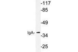 Western blot analysis of IgA antibody in extracts from HeLa cells. (Lapin anti-Humain IgA Anticorps)