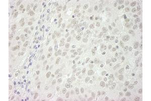 Immunohistochemistry (IHC) image for anti-Budding Uninhibited By Benzimidazoles 1 Homolog beta (Yeast) (BUB1B) (AA 1-50) antibody (ABIN7448450)