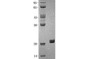 Validation with Western Blot (HPCAL1 Protein (Transcript Variant 1) (His tag))