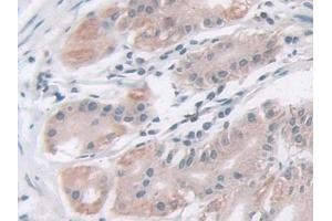 Detection of IDH2 in Human Stomach Tissue using Polyclonal Antibody to Isocitrate Dehydrogenase 2, mitochondrial (IDH2)