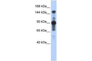 WB Suggested Anti-MINK1 Antibody Titration:  0. (MAP4K6 anticorps  (Middle Region))