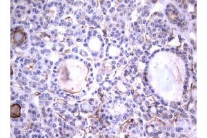 Image no. 1 for anti-Tumor Necrosis Factor Receptor Superfamily, Member 8 (TNFRSF8) (AA 19-379) antibody (ABIN1491085)