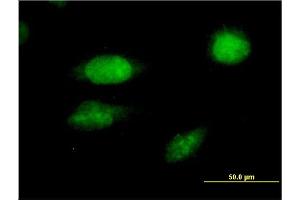 Immunofluorescence of monoclonal antibody to FOXC2 on HeLa cell. (FOXC2 anticorps  (AA 421-501))